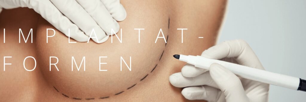 Implantatformen